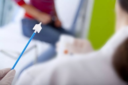 Fortschritte beim Screening von Gebärmutterhalskrebs: Die Rolle von HPV-Tests selbst sammeln
