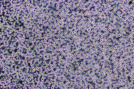 Kartoffel -Dextrose -Agar (USP) - Zuverlässiges Medium für Schimmel- und Hefendekennung