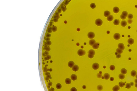 Babio startet hochwertige Baird-Parker-Agar-Basis für zuverlässige Staphylococci-Tests
