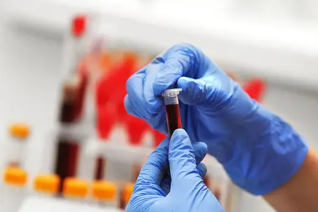 Schnelle Malariaerkennung: Das Dual-Antigen-Testkit von BABIO stärkt die globale Gesundheit